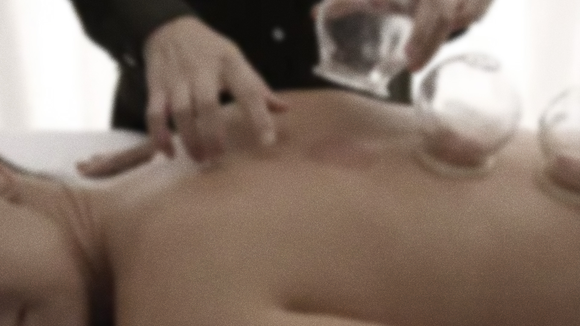cupping